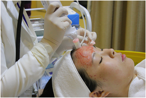 首届微针方法研讨会在上海华美医疗美容医院圆满成功